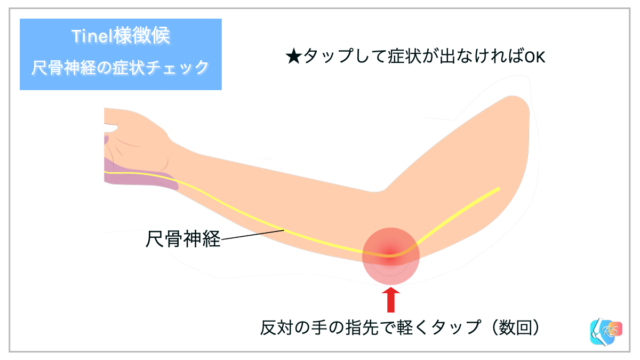 尺骨神経　尺骨神経障害　Tinel様徴候